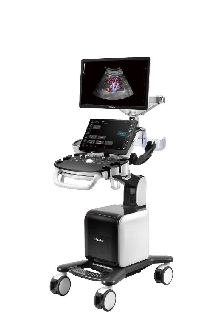Consona N8 Diagnostic Ultrasound System - ZST+ Platform - Extraordinary ultrasound evolution with channel data processing